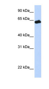 Growth Hormone Receptor / GHR Antibody - GHR / Growth Hormone Receptor antibody Western blot of Fetal Muscle lysate. This image was taken for the unconjugated form of this product. Other forms have not been tested.
