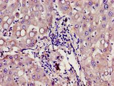 Growth Hormone Receptor / GHR Antibody - Immunohistochemistry image of paraffin-embedded human liver tissue at a dilution of 1:100