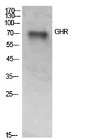 Growth Hormone Receptor / GHR Antibody - Western Blot analysis of extracts from SKOV3 cells using GHR Antibody.