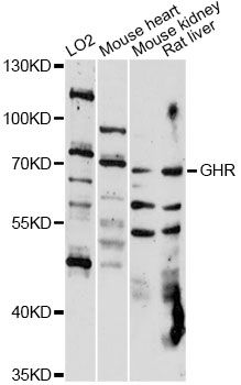Growth Hormone Receptor / GHR Antibody - Western blot analysis of extracts of various cell lines, using GHR antibody at 1:1000 dilution. The secondary antibody used was an HRP Goat Anti-Rabbit IgG (H+L) at 1:10000 dilution. Lysates were loaded 25ug per lane and 3% nonfat dry milk in TBST was used for blocking. An ECL Kit was used for detection and the exposure time was 30s.
