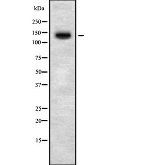 Growth Hormone Receptor / GHR Antibody - Western blot analysis GHR using HepG2 whole cells lysates