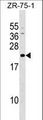 GRPEL1 Antibody - GRPEL1 Antibody western blot of ZR-75-1 cell line lysates (35 ug/lane). The GRPEL1 antibody detected the GRPEL1 protein (arrow).
