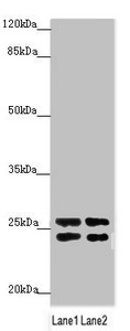 GRPEL1 Antibody - Western blot All Lanes:GRPEL1 antibody at 2.65 ug/ml Lane 1: A431 whole cell lysate Lane 2: 293T whole cell lysate Secondary Goat polyclonal to rabbit IgG at 1/10000 dilution Predicted band size: 24 kDa Observed band size: 24,26 kDa