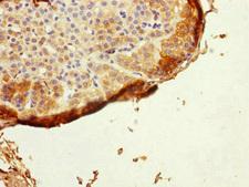 GRPEL1 Antibody - Immunohistochemistry of paraffin-embedded human adrenal gland tissue at dilution of 1:100