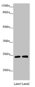 GRPEL1 Antibody - Western blot All Lanes:GRPEL1 antibody at 1.37 ug/ml Lane 1: A431 whole cell lysate Lane 2: 293T whole cell lysate Secondary Goat polyclonal to rabbit IgG at 1/10000 dilution Predicted band size: 24 kDa Observed band size: 24 kDa