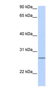 GRPEL2 Antibody - GRPEL2 antibody Western blot of Fetal Heart lysate. This image was taken for the unconjugated form of this product. Other forms have not been tested.