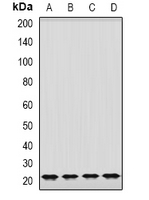 GRPEL2 Antibody - Western blot analysis of GrpEL2 expression in K562 (A); MCF7 (B); mouse brain (C); mouse lung (D) whole cell lysates.