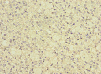 GRPEL2 Antibody - Immunohistochemistry of paraffin-embedded human adrenal gland tissue at dilution 1:100
