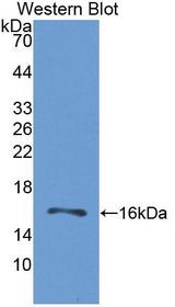 GRPR Antibody - Western blot of GRPR antibody.