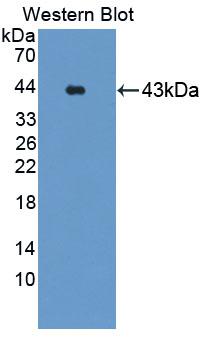 GRPR Antibody - Western blot of GRPR antibody.