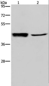 GRPR Antibody - Western blot analysis of Human hepatocellular carcinoma tissue and A549 cell, using GRPR Polyclonal Antibody at dilution of 1:300.