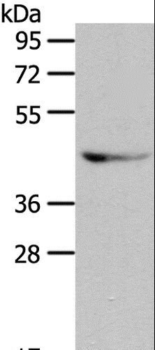 Anti-GRPR Antibody | Rabbit anti-Human Polyclonal ELISA,WB | LSBio