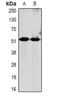 GRPR Antibody - Western blot analysis of GRPR expression in mouse brain (A); rat brain (B) whole cell lysates.