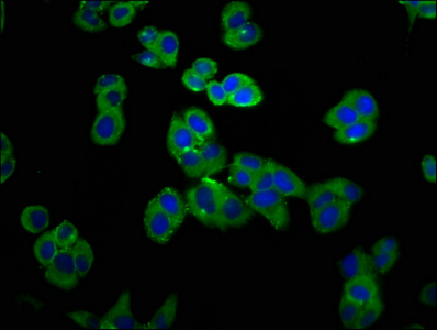 GRPR Antibody - Immunofluorescence staining of PC3 cells at a dilution of 1:100, counter-stained with DAPI. The cells were fixed in 4% formaldehyde, permeabilized using 0.2% Triton X-100 and blocked in 10% normal Goat Serum. The cells were then incubated with the antibody overnight at 4 °C.The secondary antibody was Alexa Fluor 488-congugated AffiniPure Goat Anti-Rabbit IgG (H+L) .