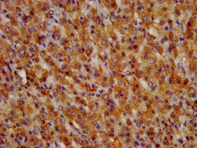 GRPR Antibody - IHC image of GRPR Antibody diluted at 1:300 and staining in paraffin-embedded human adrenal gland tissue performed on a Leica BondTM system. After dewaxing and hydration, antigen retrieval was mediated by high pressure in a citrate buffer (pH 6.0). Section was blocked with 10% normal goat serum 30min at RT. Then primary antibody (1% BSA) was incubated at 4°C overnight. The primary is detected by a biotinylated secondary antibody and visualized using an HRP conjugated SP system.