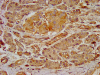 GRPR Antibody - IHC image of GRPR Antibody diluted at 1:300 and staining in paraffin-embedded human pancreatic tissue performed on a Leica BondTM system. After dewaxing and hydration, antigen retrieval was mediated by high pressure in a citrate buffer (pH 6.0). Section was blocked with 10% normal goat serum 30min at RT. Then primary antibody (1% BSA) was incubated at 4°C overnight. The primary is detected by a biotinylated secondary antibody and visualized using an HRP conjugated SP system.
