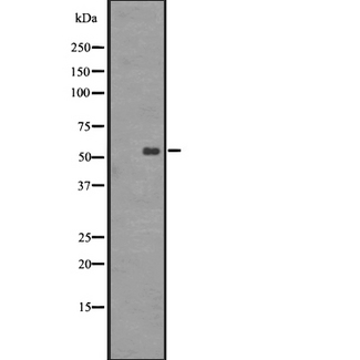 GRPR Antibody - Western blot analysis of GRPR expression in A431 whole cells lysate. The lane on the left is treated with the antigen-specific peptide.