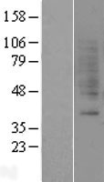 GRPR Protein - Western validation with an anti-DDK antibody * L: Control HEK293 lysate R: Over-expression lysate