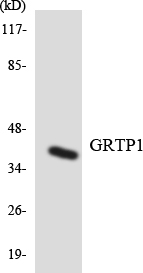 GRTP1 Antibody - Western blot analysis of the lysates from Jurkat cells using GRTP1 antibody.
