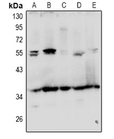 GRTP1 Antibody - Western blot analysis of GRTP1 expression in A549 (A), Jurkat (B), THP1 (C), PC12 (D), Raw264.7 (E) whole cell lysates.