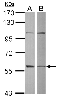 GRWD1 Antibody - Sample (30 ug of whole cell lysate) A: 293T B: Raji 7.5% SDS PAGE GRWD1 antibody diluted at 1:500