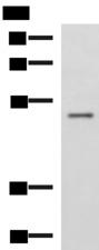 GRWD1 Antibody - Western blot analysis of Human placenta tissue lysate  using GRWD1 Polyclonal Antibody at dilution of 1:800