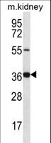 GRXCR1 Antibody - GRXCR1 Antibody western blot of mouse kidney tissue lysates (35 ug/lane). The GRXCR1 antibody detected the GRXCR1 protein (arrow).