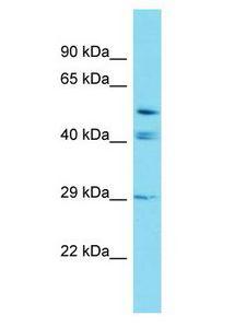 GRXCR2 Antibody - GRXCR2 antibody Western Blot of Placenta. Antibody dilution: 1 ug/ml.  This image was taken for the unconjugated form of this product. Other forms have not been tested.