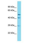 GRXCR2 Antibody - GRXCR2 antibody Western Blot of Placenta. Antibody dilution: 1 ug/ml.  This image was taken for the unconjugated form of this product. Other forms have not been tested.