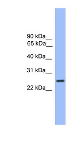 GS28 / GOSR1 / p28 Antibody - GOSR1 antibody Western blot of Fetal Liver lysate.  This image was taken for the unconjugated form of this product. Other forms have not been tested.