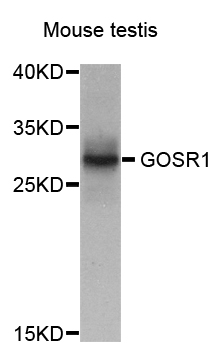 GS28 / GOSR1 / p28 Antibody - Western blot analysis of extract of various cells.