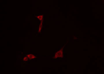 GS28 / GOSR1 / p28 Antibody - Staining COLO205 cells by IF/ICC. The samples were fixed with PFA and permeabilized in 0.1% Triton X-100, then blocked in 10% serum for 45 min at 25°C. The primary antibody was diluted at 1:200 and incubated with the sample for 1 hour at 37°C. An Alexa Fluor 594 conjugated goat anti-rabbit IgG (H+L) antibody, diluted at 1/600, was used as secondary antibody.