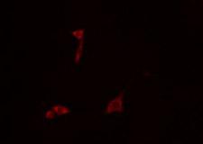 GS28 / GOSR1 / p28 Antibody - Staining COLO205 cells by IF/ICC. The samples were fixed with PFA and permeabilized in 0.1% Triton X-100, then blocked in 10% serum for 45 min at 25°C. The primary antibody was diluted at 1:200 and incubated with the sample for 1 hour at 37°C. An Alexa Fluor 594 conjugated goat anti-rabbit IgG (H+L) antibody, diluted at 1/600, was used as secondary antibody.