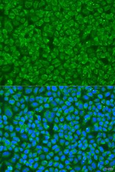 GS28 / GOSR1 / p28 Antibody - Immunofluorescence analysis of U2OS cells using GOSR1 Polyclonal Antibody at dilution of 1:100.Blue: DAPI for nuclear staining.