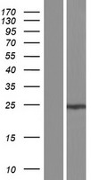 GS28 / GOSR1 / p28 Protein - Western validation with an anti-DDK antibody * L: Control HEK293 lysate R: Over-expression lysate