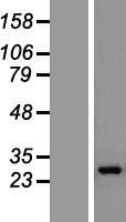 GS28 / GOSR1 / p28 Protein - Western validation with an anti-DDK antibody * L: Control HEK293 lysate R: Over-expression lysate