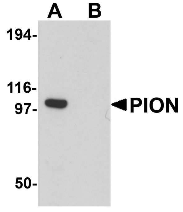 GSAP / PION Antibody - Western blot analysis of PION in EL4 cell lysate with PION antibody at 0.25 ug/ml in (A) the absence and (B) the presence of blocking peptide.