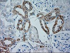 GSC / Goosecoid Antibody - IHC of paraffin-embedded Human Kidney tissue using anti-GSC mouse monoclonal antibody.