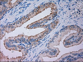 GSC / Goosecoid Antibody - IHC of paraffin-embedded Human prostate tissue using anti-GSC mouse monoclonal antibody.
