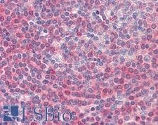 GSC / Goosecoid Antibody - Spleen: Formalin-Fixed, Paraffin-Embedded (FFPE).  This image was taken for the unconjugated form of this product. Other forms have not been tested.