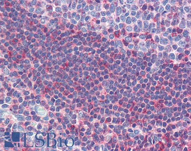 GSC / Goosecoid Antibody - Anti-GSC antibody IHC of human tonsil. Immunohistochemistry of formalin-fixed, paraffin-embedded tissue after heat-induced antigen retrieval. Antibody concentration 5 ug/ml.  This image was taken for the unconjugated form of this product. Other forms have not been tested.