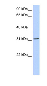 GSC / Goosecoid Antibody - GSC antibody Western blot of 721_B cell lysate. This image was taken for the unconjugated form of this product. Other forms have not been tested.