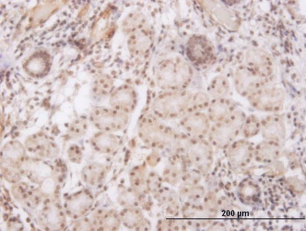 GSC / Goosecoid Antibody - Immunoperoxidase of monoclonal antibody to GSC on formalin-fixed paraffin-embedded human salivary gland. [antibody concentration 3 ug/ml]