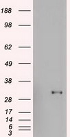 GSC / Goosecoid Antibody - Goosecoid antibody (1D7) at1:1000 dilution + lysates from HEK-293T cells transfected with human Gooscoid expression vector.