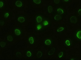 GSC / Goosecoid Antibody - Anti-GSC mouse monoclonal antibody  immunofluorescent staining of HeLa cells transiently transfected by pCMV6-ENTRY GSC.