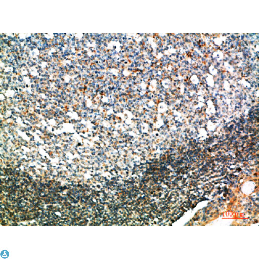 GSC / Goosecoid Antibody - Immunohistochemical analysis of paraffin-embedded human-tonsil, antibody was diluted at 1:200.