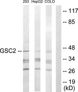 GSCL / GSC2 Antibody - Western blot analysis of lysates from 293, HepG2, and COLO205 cells, using GSC2 Antibody. The lane on the right is blocked with the synthesized peptide.