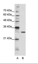 GSCL / GSC2 Antibody - A: Marker, B: HepG2 Cell Lysate.  This image was taken for the unconjugated form of this product. Other forms have not been tested.
