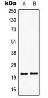 GSCL / GSC2 Antibody - Western blot analysis of GSC2 expression in HepG2 (A); Jurkat (B) whole cell lysates.