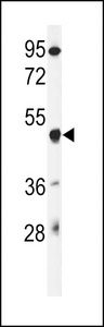 GSDMA Antibody - Western blot of GSDMA Antibody in mouse liver tissue lysates (35 ug/lane). GSDMA (arrow) was detected using the purified antibody.